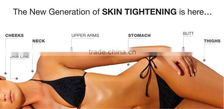 RF Roller Cryo Cold Slim Cellulite Removal Spa Cooling Therapy criolipolise machine