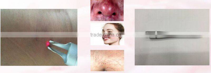 2016 newest Oem Service 980nm diode laser vascular removal machine price