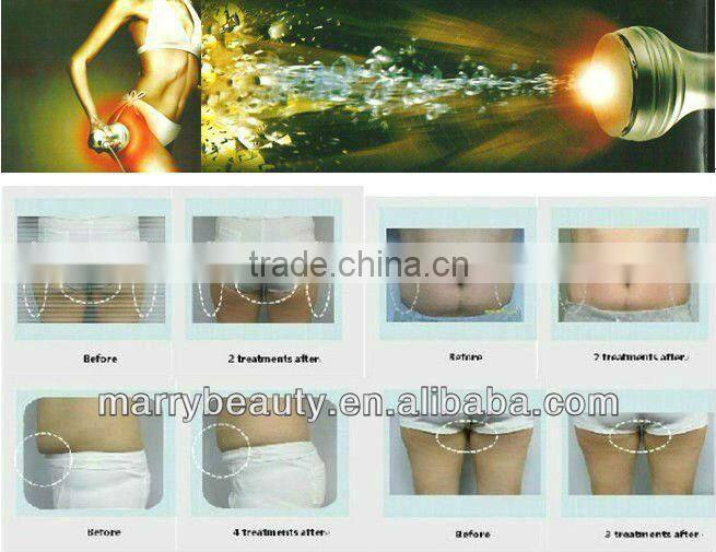 2016 5 in 1 cavitation machine for silmming