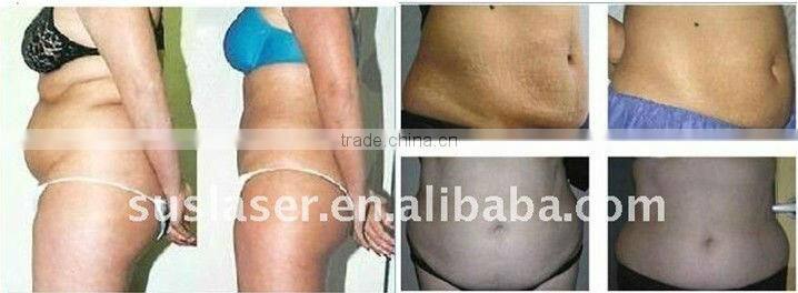 Hot!! Portable fat cavitation slimming machine S50(CE&ISO)lipo cavitation machine gel