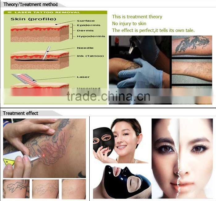 New designed powerful shr ipl laser hair removal machine for sale