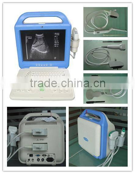 Portable LCD Display Ultrasound Scanner AJ-6100B LCD
