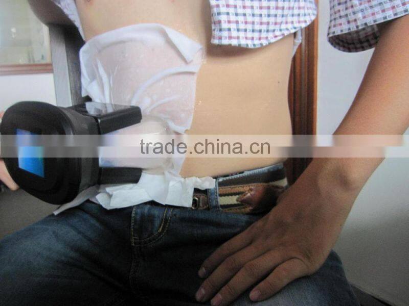 guangzhou hotsale Cryolipolysis fat freezing machine to weight loss