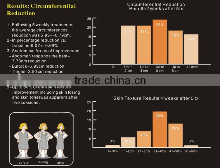 Radio Wave Frequency Machine Ultrasonic Head Vibrating Massage Equipment