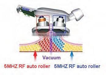 RF Vacuum Roller Warm Massage Skin Tightening With Lipocavitation For Body Shaping
