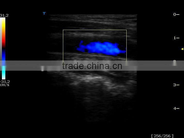 hot sale color doppler ultrasound for hot sale