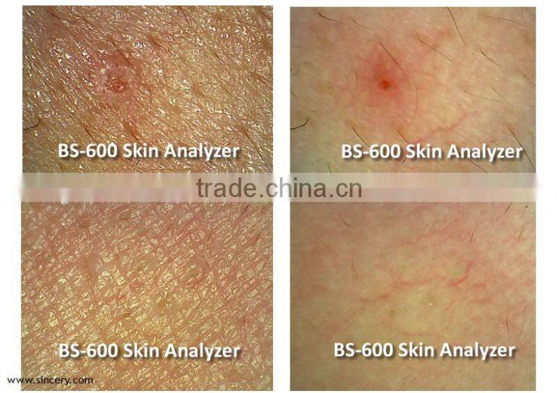 Portable high quality skin scanner/Mini skin and hair scanner