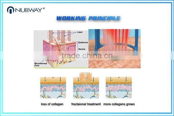 USA Laser Vaginal Tighten Medical Use RF Fractional Co2 Laser