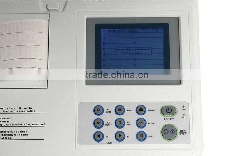 2016 new Portable Digital 3-channel Color Electrocardiograph ECG EKG machine on sale