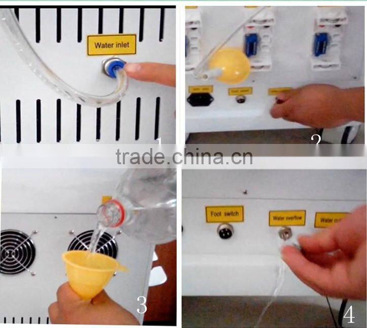 Perfect 3 in 1 IPL Yag laser RF freckle removal beauty machine