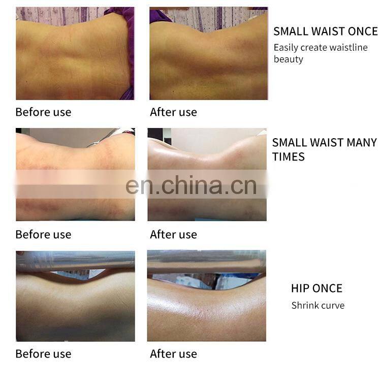 3 IN 1 Body Shaping Machine Microwave+Microcurrent+Vacuum Negative Pressure Weight Loss Device Body Physiotherapy Massage