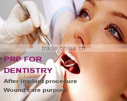 small TD4C hot sale PRP centrifuge separating 10ml PRP tube/kit