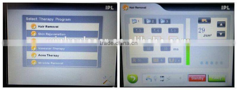 hair removal products/lazer hair removal machine/portable laser hair removal