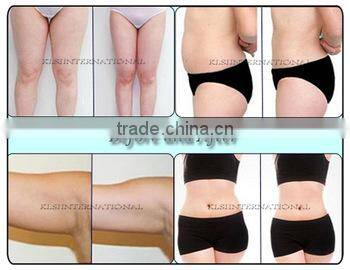 klsi hifu beauty machine Bipolar RF best ultrasound cavitation machine for home use