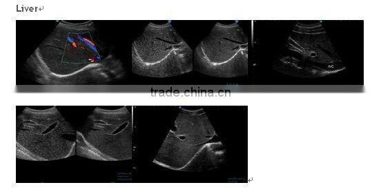 Abdominal/ Vascular/OB/GYN/4D Ultrasound iSpark 480 with CE Approved