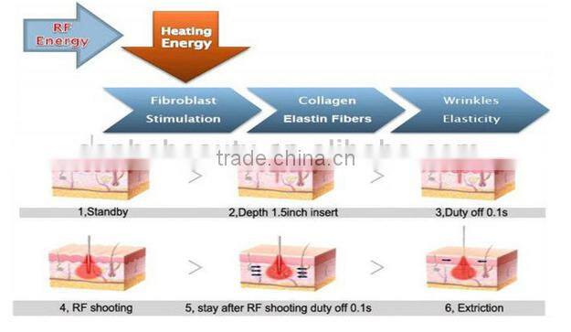 2016 best Micro Needle RF and Fractional RF system/ spider vein removal machine