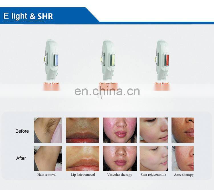 Skin rejuvenation shr  machine beauty equipment