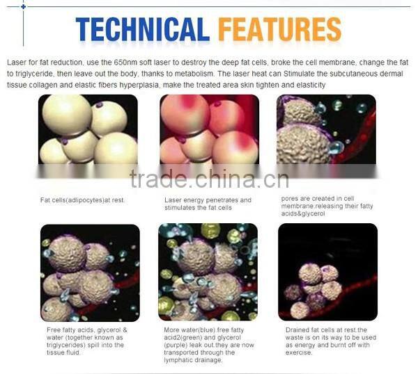 HOT lipolaser body laser slimming machine SW-L90 with ISO and CE certificate