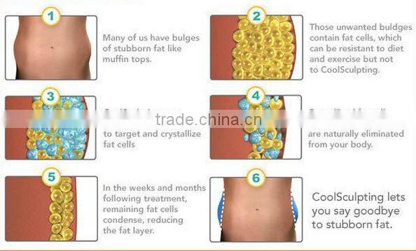 Hot promotion!!!!! 2016 Newest Beauty Equipment Cryolipolysi Fat Reducing Machine