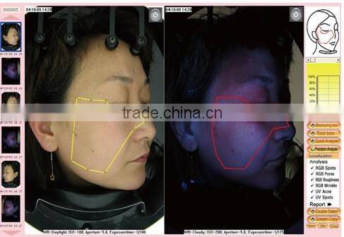 hot sell magic mirror facial skin analyzer / 3d face camera