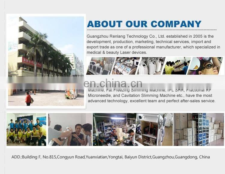 Hot sale cryo weight loss machine cyrolipolysis slimming machine/cryolipo slimming machine