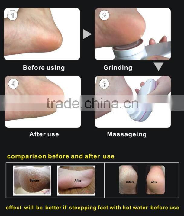 multifunction foot calus remover electric exfoliating scrub machine