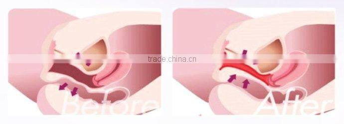 portable thermae portable thermae vaginal tightening China supplier for home use