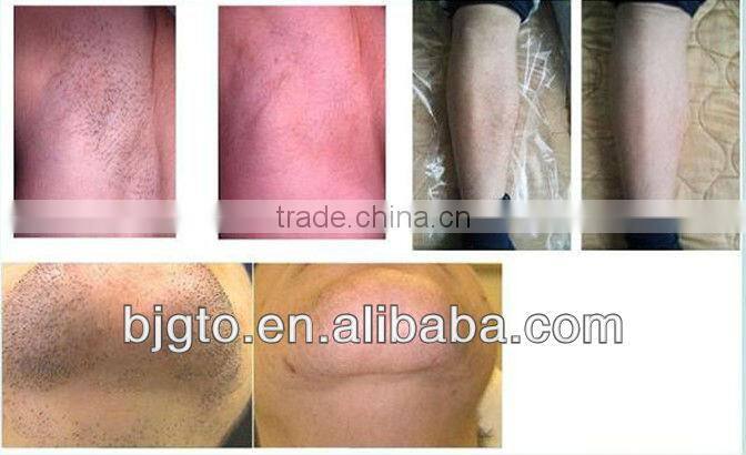 2013 the newest professional SHR ipl equipment hair removal
