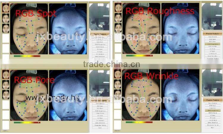 Newest skin health analysis machine/portable hair and skin analyser equipment