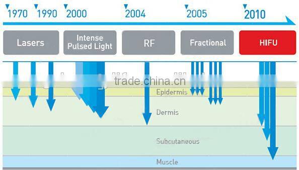 Vertical hifu machine/hifu face lift