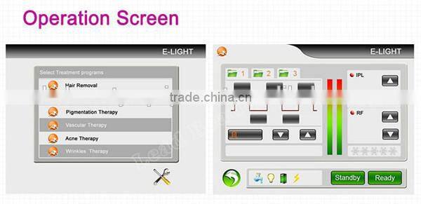 New arrival hot wax machine hair removal