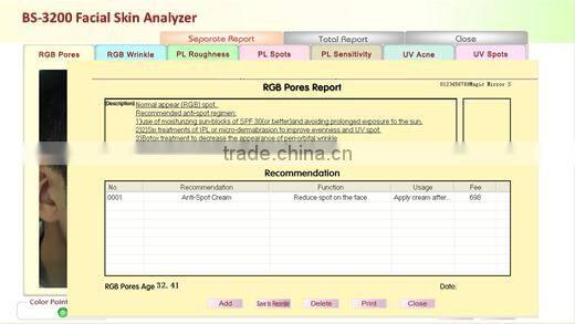 2014 Newest computer skin analyzer Suitable For Windows 8 and windows 8.1