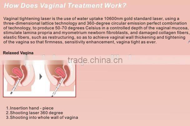 Effective women deep wrinkle removal CO2 fractional RF tube machine