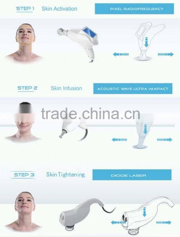 2015 new hot sale beauty radiofrequency rf laser skin rejuvenation device