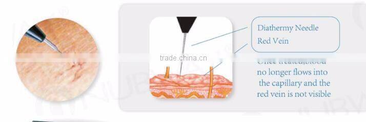 Professional Spider Vein GSD Professional High-frequency laser vascular removal