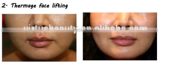 2 years garrantee multifunction hair removal ipl RF Nd yag laser& Black doll laser machine