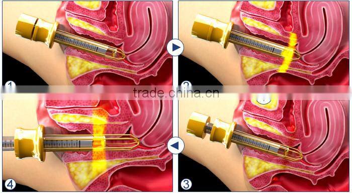 co2 fractional laser wart removal scar removal beauty cutting machine