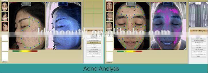 Multi Function light facial skin analysis machine for Skin Sensitiveness And Age Test