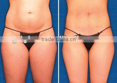 2016 GLM top design!Beauty Equipment--B-022A Criolipolisis Vacuum Roller(V9) EMS RF beauty machine with CE for sale