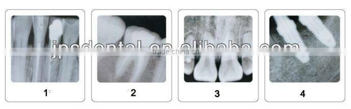 Digital portable dental X-Ray AP-60P