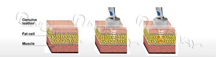 Hot sale! high frequency focused ultrasound roller lipo cavitation machine for full body slim