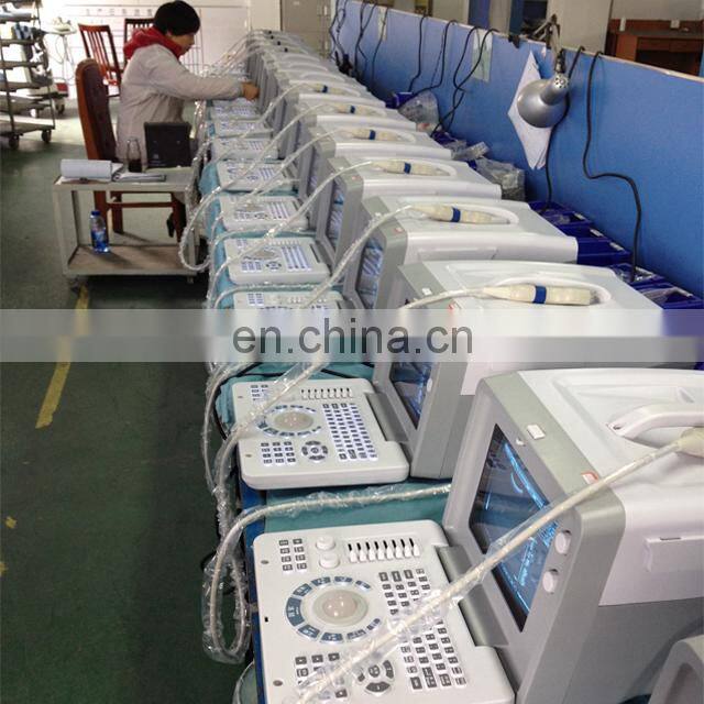 HC-A001 Happycare Full digital Portable 10 inch laptop ultrasound machine scanner Cheapest cheap ultrasound machine device