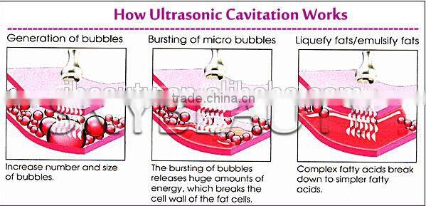 rf cavitation body slimming face fat removal beauty machine