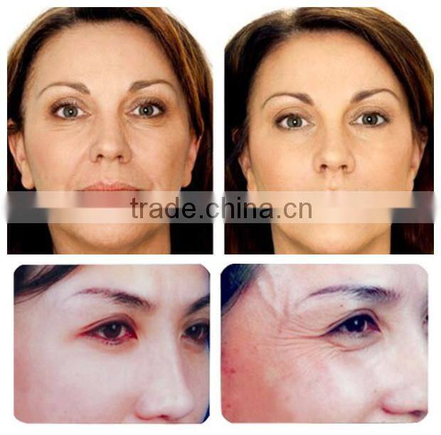 best effective!!! rf thermacool machine,rf fractional micro needle,fractional rf microneedle(skin rejuvenation quickly fast!!!!)