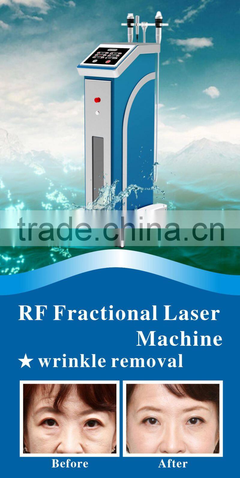 2016 Mirco needle beauty machine for skin rejuvenation with CE approved for beauty spa and salon