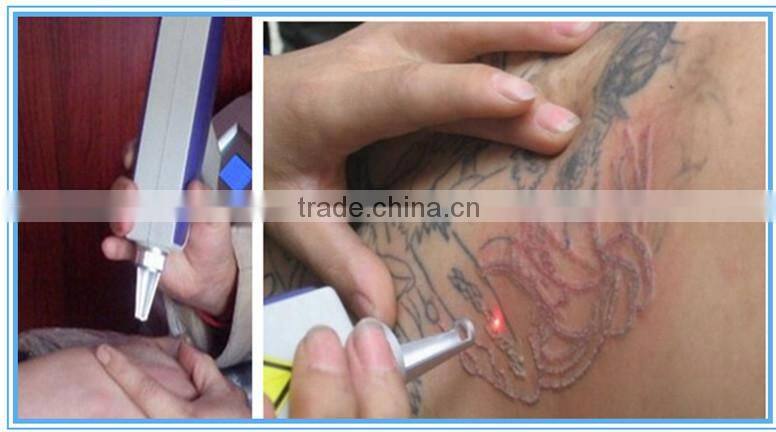 Professional Q-switch nd:yag laser machine for tattoo removal