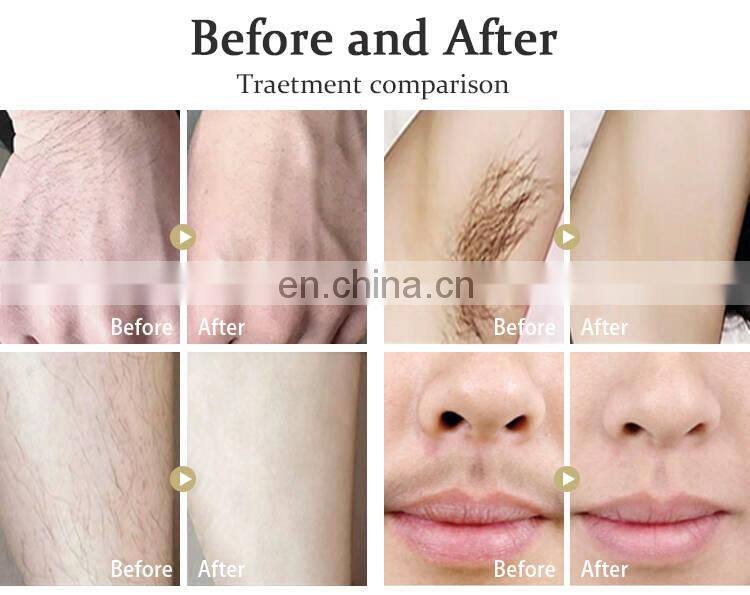 Portable 808nm Diode Lazer / Laser Diode 808 Hair RemovalFor Permanent Hair Removal