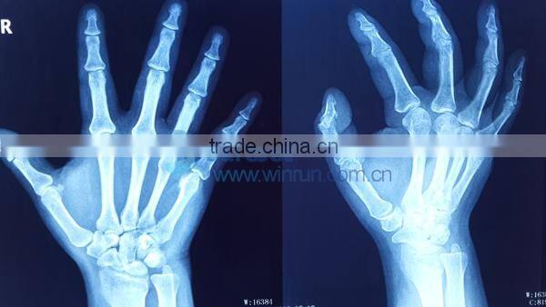 HD Medical Film Special Ink