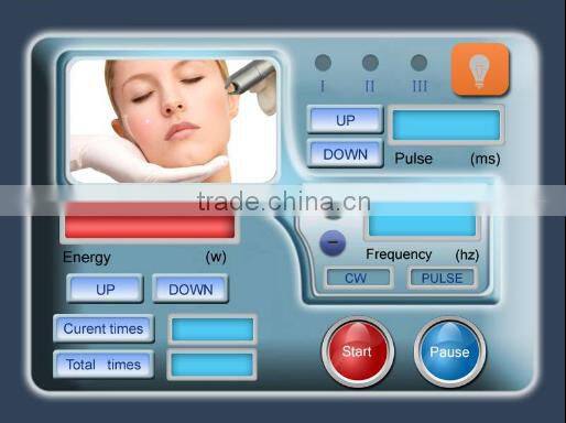 permanent remove vascular machine by 980nm diode laser