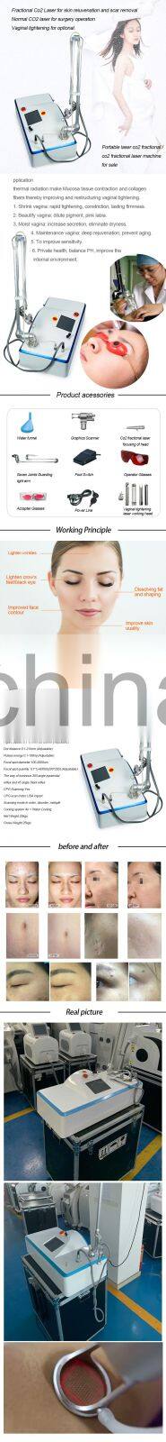 Fractional CO2 Laser Device CO2 Laser For Anti Aging Wrinkle Scars Removal Vaginal Tighten Fractional CO2 Laser